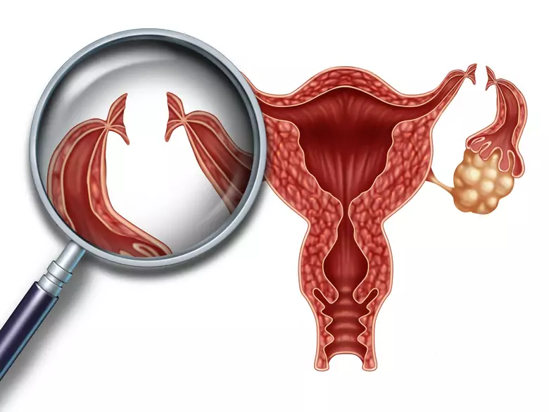 Macica i jej związek z... pamięcią