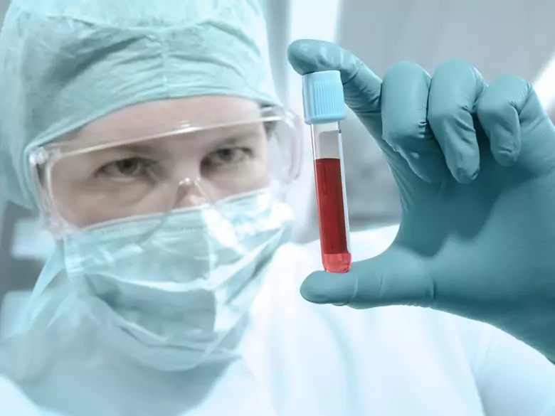 Czy ryzyko zakażenia wirusem HIV dotyczy także kobiet ciężarnych?