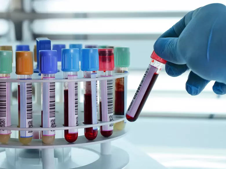 Czy warto bankować krew pępowinową?