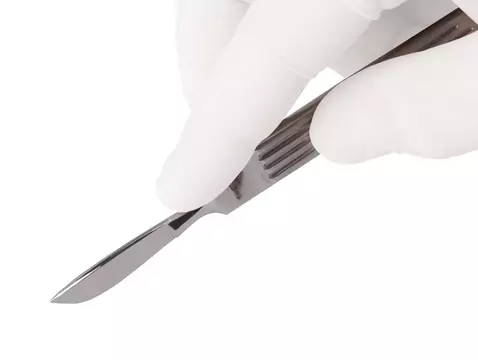 Podwiązanie jajowodów