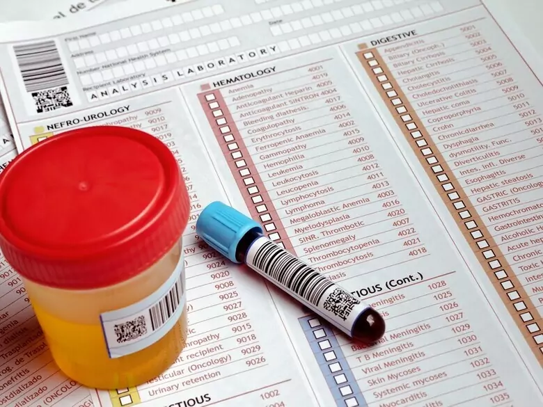 Endokrynologia okresu menopauzy